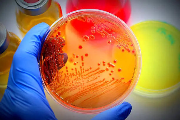 Microbial test for lemon yellow, carrot orange, antler brown Anka Bella